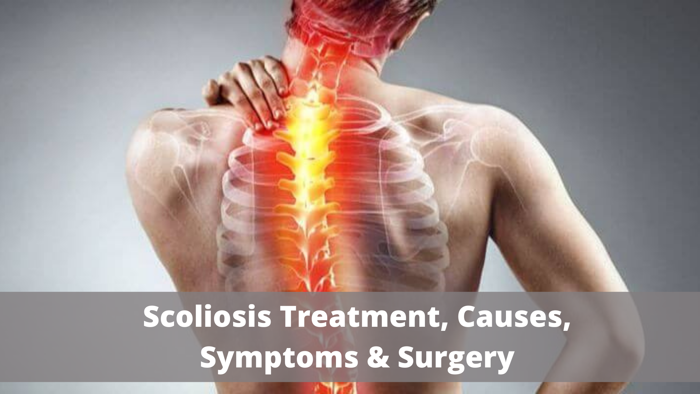 Scoliosis-Types-Causes-Symptoms-Treatment