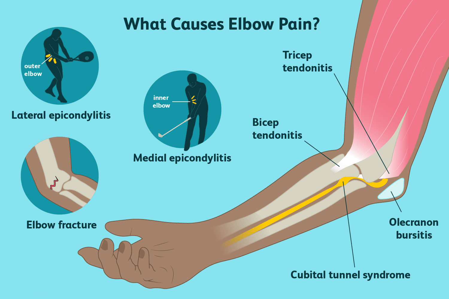 Elbow stiffness physiotherapy treatment in Noida
