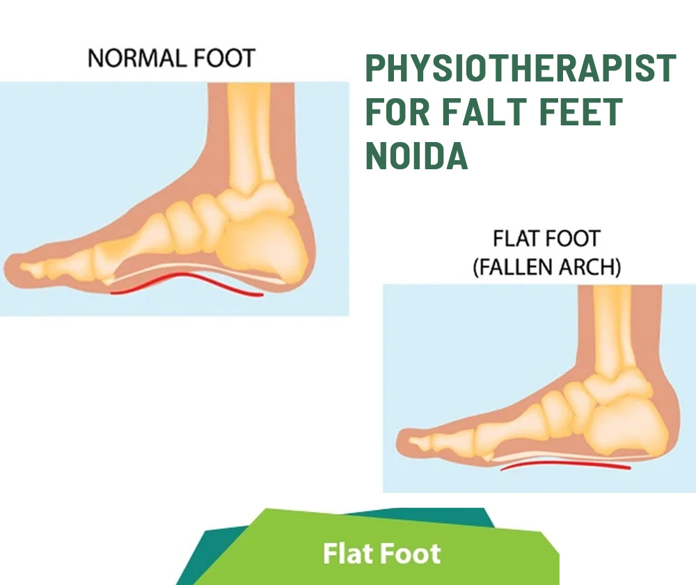 physiotherapy clinic for flat-feet